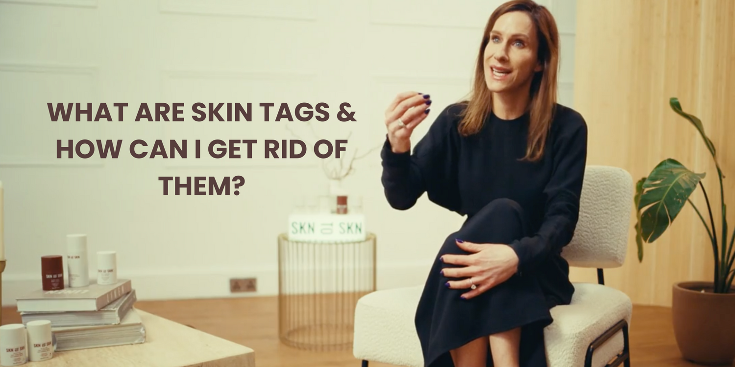 What Are Skin Tags And How Can I Get Rid Of Them?
