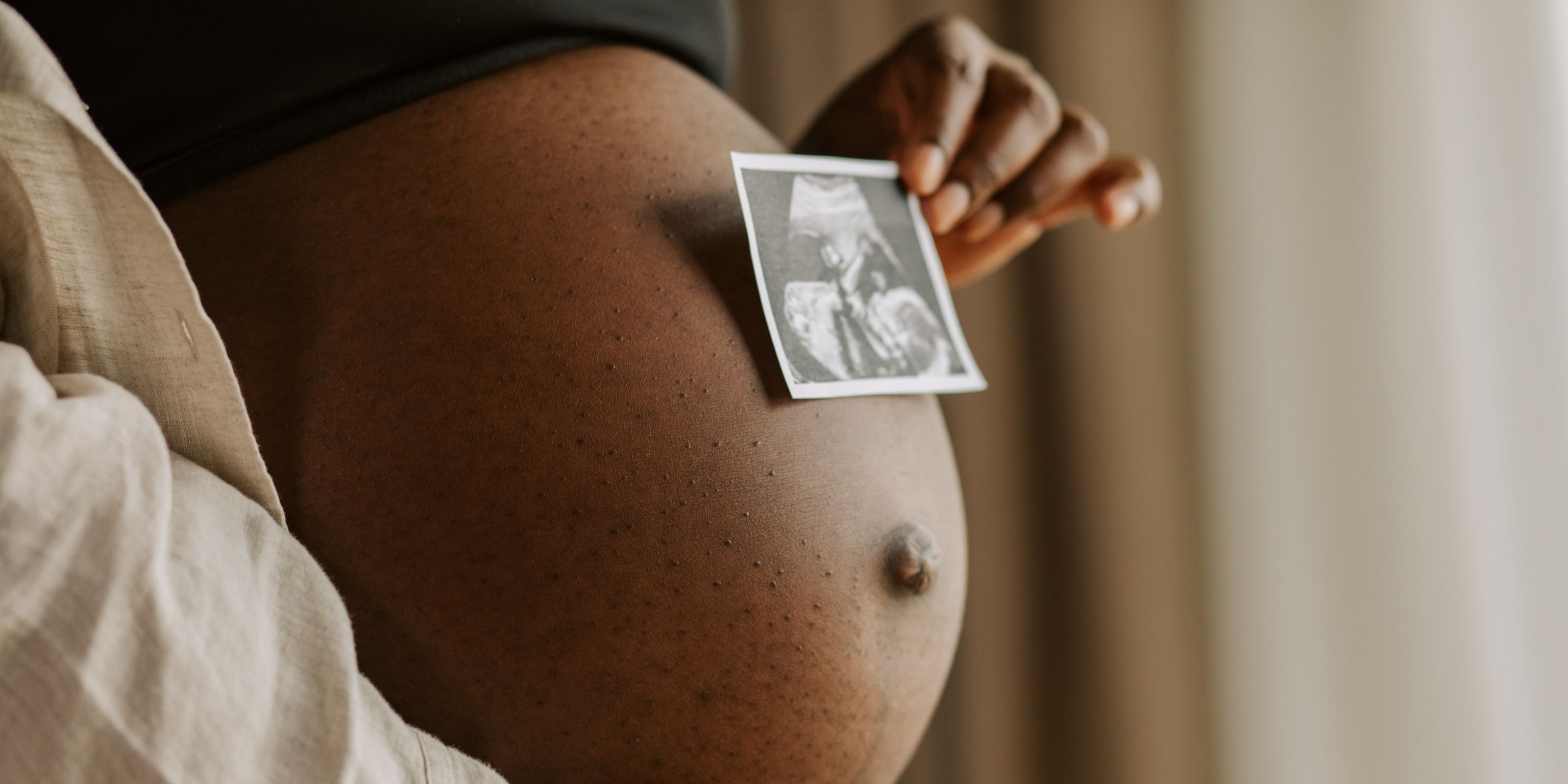 Hormonal acne during pregnancy | Causes and how to treat it | SKN TO SKN