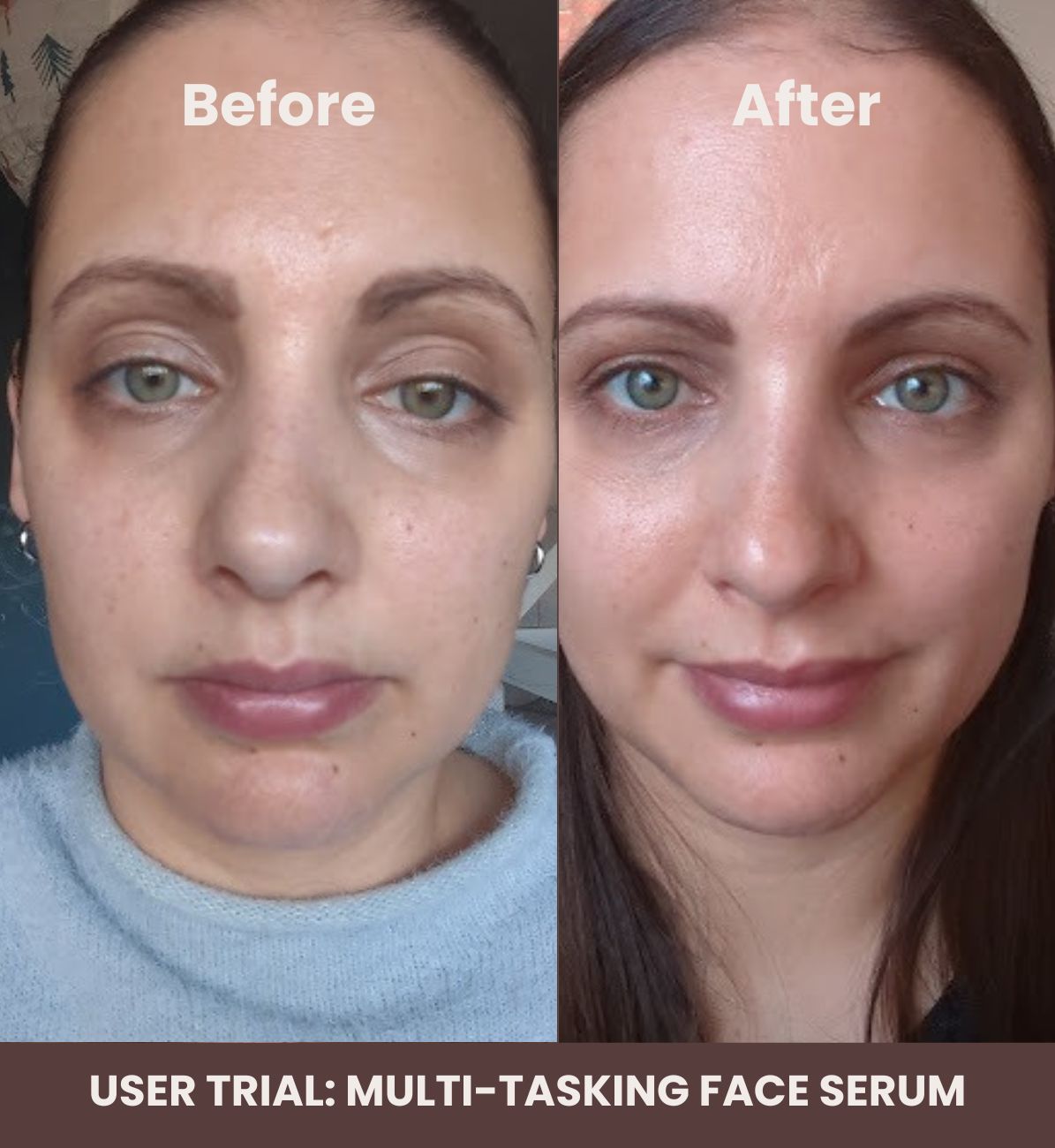 user trial serum