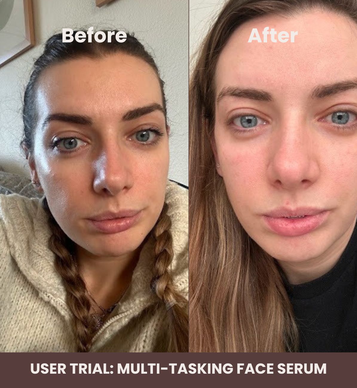 serum before and after