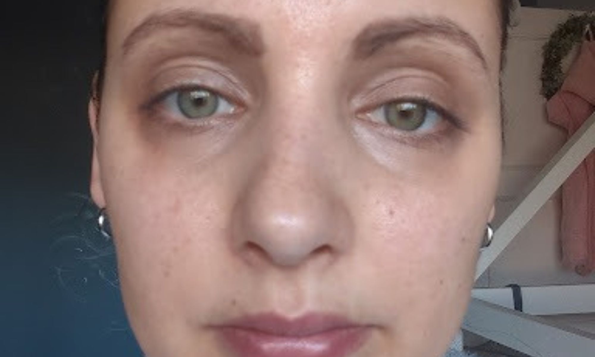 serum before