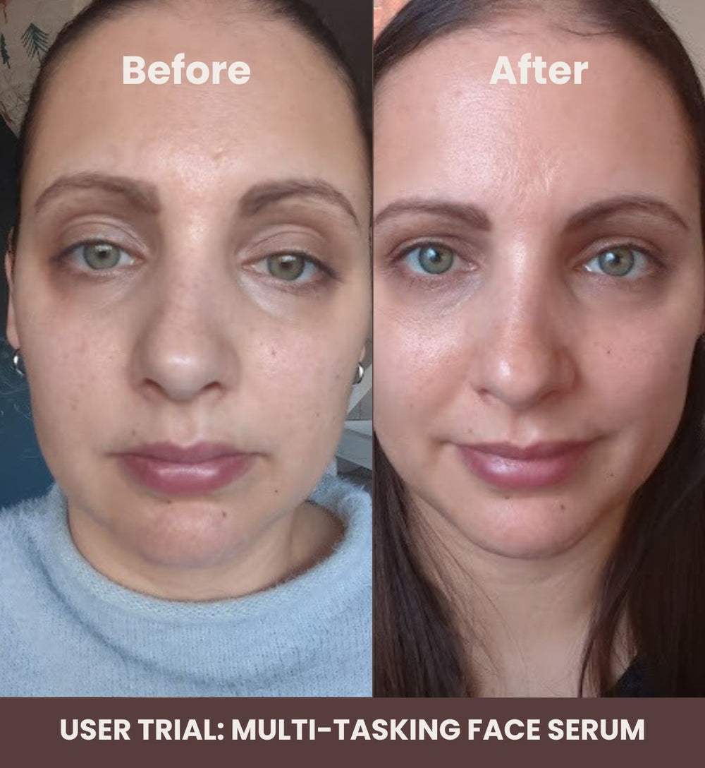 Multi-Tasking Face Serum | SKN TO SKN